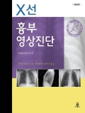 Isbn# is : 8962789272